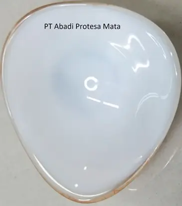 protesa mata belakang protesa mata belakang