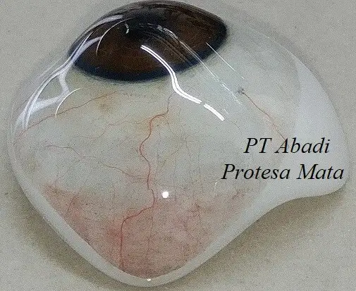 Sklera Abadi Protesa Mata Sklera Abadi Protesa Mata